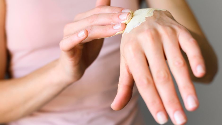 Cum îngrijești pielea după purtarea îndelungată a unui plasture medical